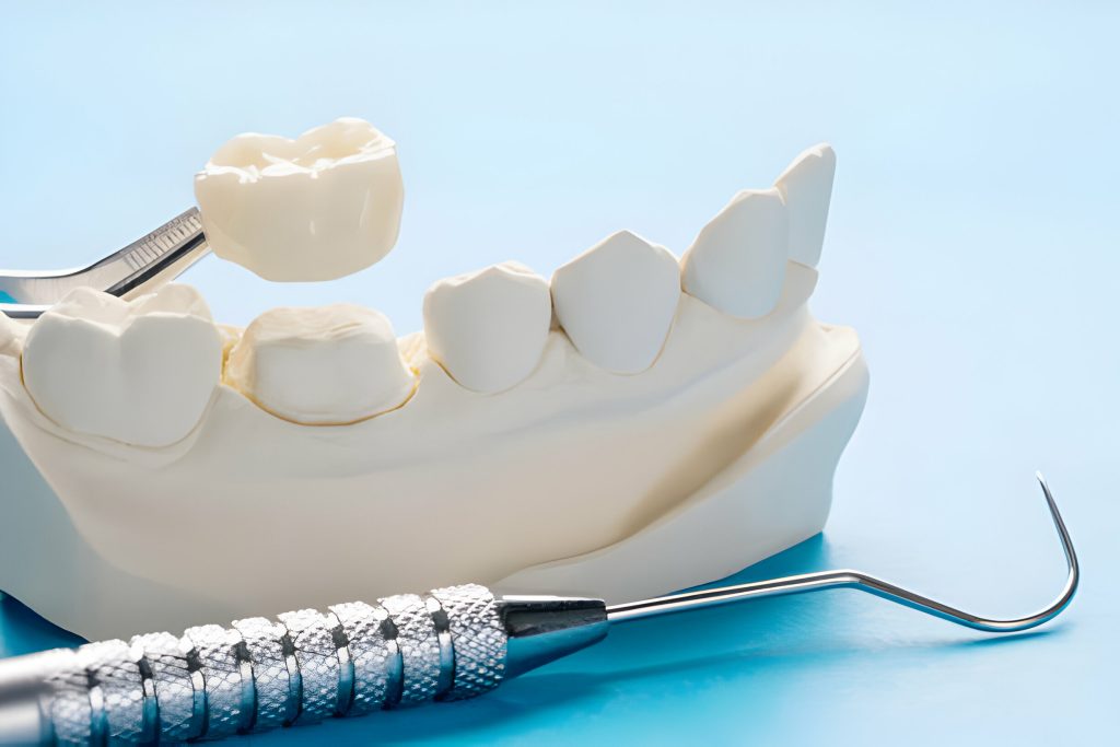 crowns dentistry